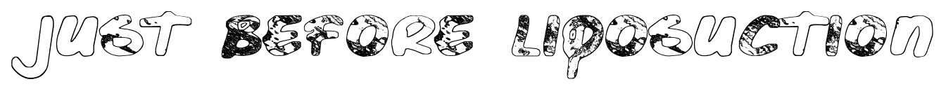 Just Before Liposuction font